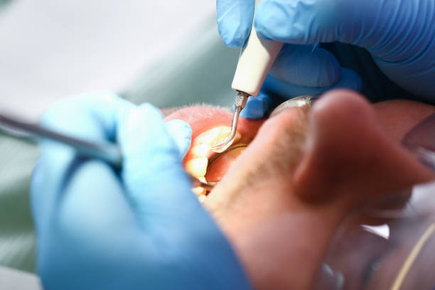Best Pediatric Emergency Dentist in Fairmont, WV